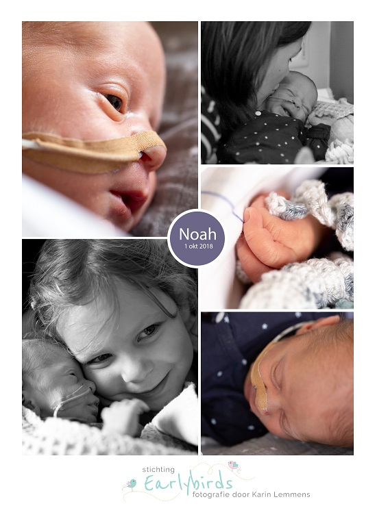 Noah prematuur geboren met 34 weken, MMC Veldhoven, spoedkeizersnede, HELLP syndroom, NICU, sonde