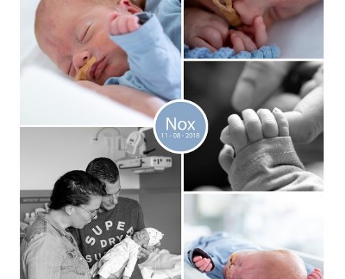 Nox prematuur geboren met 30 weken, Zuyderland ziekenhuis Heerlen, borstvoeding, sonde