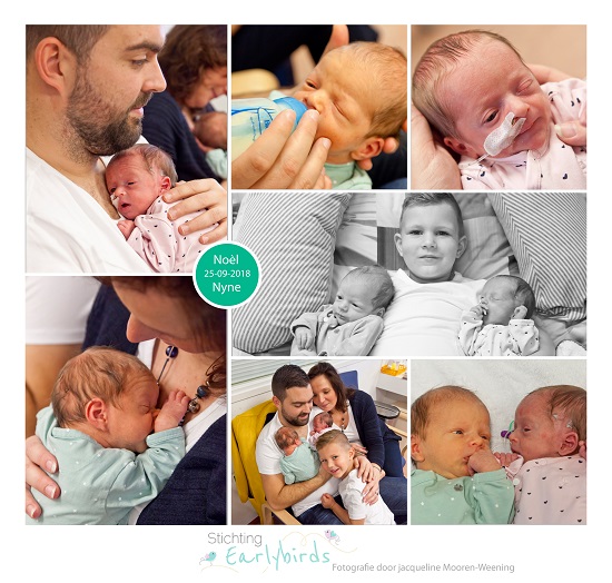 Noèl & Nyne prematuur gebore met 37 weken, tweeling, sonde, longrijping, stuitigging, Ny Smellinghe, keizersnede, couveuse