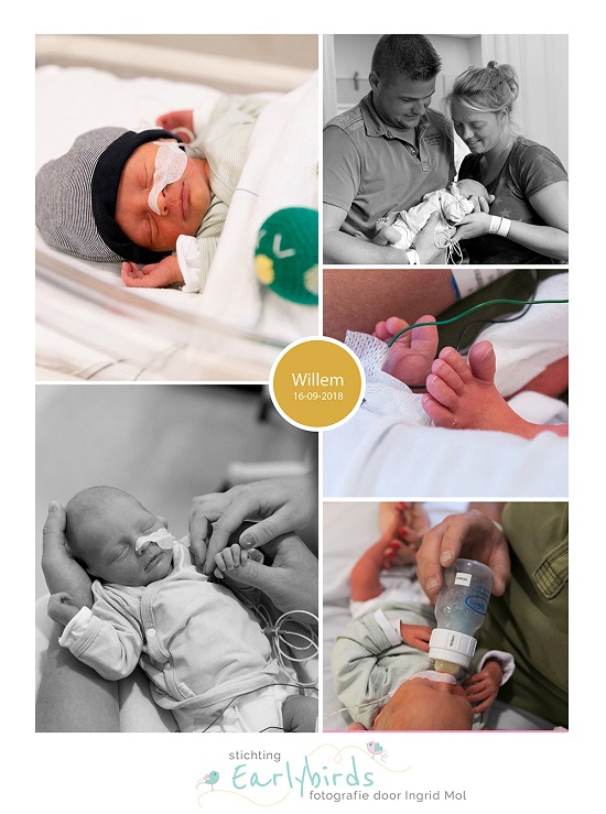 Willem prematuur geboren met 34 weken en 3 dagen, sondevoeding, couveuse, vroeggeboorte