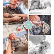 Boaz prematuur geboren met 32- weken, Slingeland ziekenhuis Doetinchem, sonde, zwangerschapsvergiftiging, keizersnede, CPAP, HELLP, Radboud MC, couveuse
