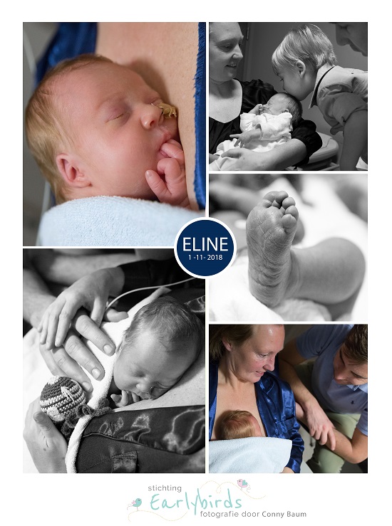 Eline prematuur geboren met 31 weken en 5 dagen, Bravis moeder en kind, buidelen