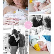 Faye prematuur geboren met 24 weken en 6 dagen, drieling zwangerschap, LUMC, sonde, buidelen, CPAP, groeiachterstand