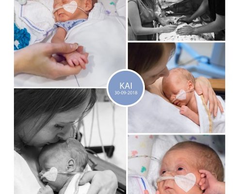 Kai prematuur geboren met 28 weken en 4 dagen Isala Zwolle, couveuse, Flevo ziekenhuis, sonde