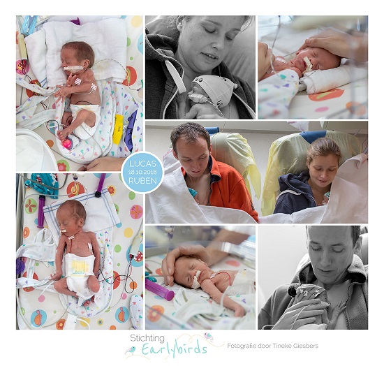 Lucas & Ruben prematuur geboren met 30 weken, tweeling, WKZ, stuitligging, spoedkeizersnede, buidelen