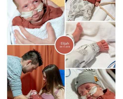 Elijah prematuur geboren met 31 weken, ASZ, borstvoeding, sonde