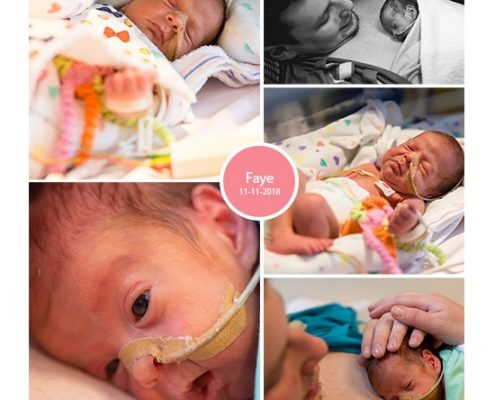 Faye prematuur geboren met 29 weken en 5 dagen, sondevoeding, MMC Veldhoven, vroeggeboorte