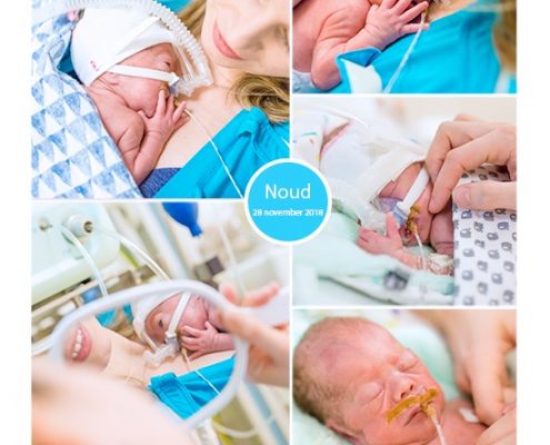 Noud prematuur geboren bij 28 weken, MMC Veldhoven, keizersnede, couveuse,buidelen, sondevoeding