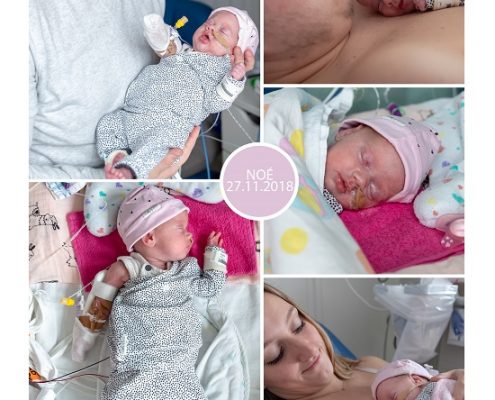 Noé prematuur geboren met 32 weken, zwnagerschapsvergiftiging, HEELP syndroom, Sophia Kinder Ziekenhuis, antibiotica, Maasstad ziekenhuis