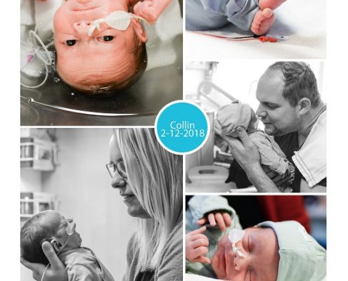 Collin prematuur gebore met 32 weken, HELLP syndroom, keizersnede, vroeggeboorte, sondevoeding
