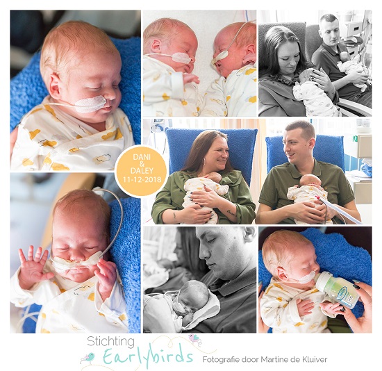 Daley & Dani prematuur geboren met 30 weken, ALbert Schweitzer ziekenhuis, tweeling, ivf, gebroken vliezen, Sophia, Maasstad, sonde