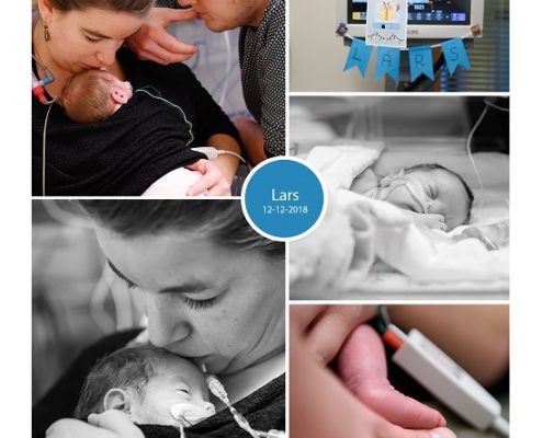 Lars prematuur geboren met 31 weken, weeenremmers, lingrijping, buidelen