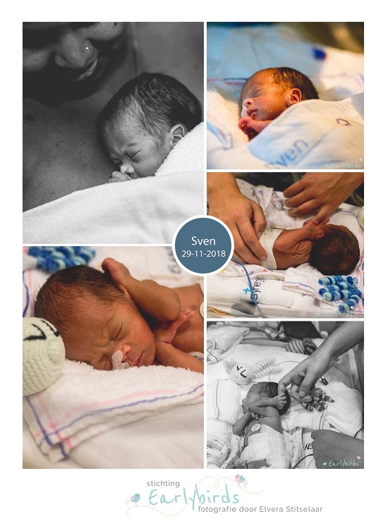 Sven prematuur geboren met 31 weken en 4 dagen, zwangerschapsdiabetes, HELLP, WKZ, keizersnede, Meander Amersfoort