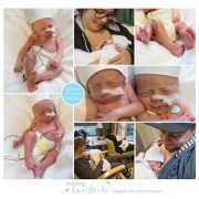 Dylano & Devano prematuur geboren met 33 weken, tweeling, Meander, longrijping, weeenremmers, WKZ, buidelen, sonde