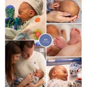Kai prematuur geboren met 35 weken, Bravis, groeiachterstand, hoge bloeddruk, CPAP, couveuse, sonde