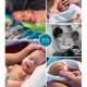 Noud prematuur geboren met 30 weken en 2 dagen, tweeling, groeiachterstand, CTG, longrijping, buidelen, keizersnede, antibiotica, Sophia