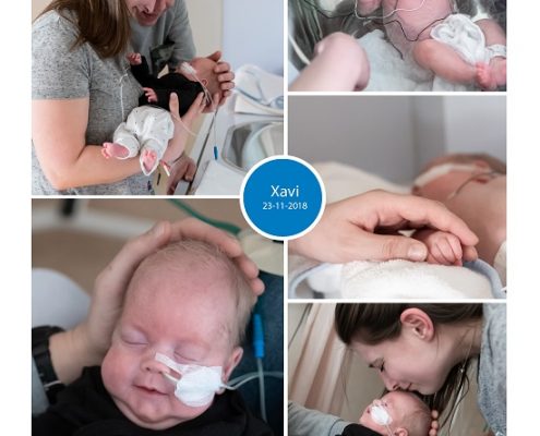 Xavi prematuur geboren met 25 weken en 2 dagen, sonde, Amphia Breda, ICSI, Sophia Kinderziekenhuis, weeenremmers, longrijping, EMC, stuitligging