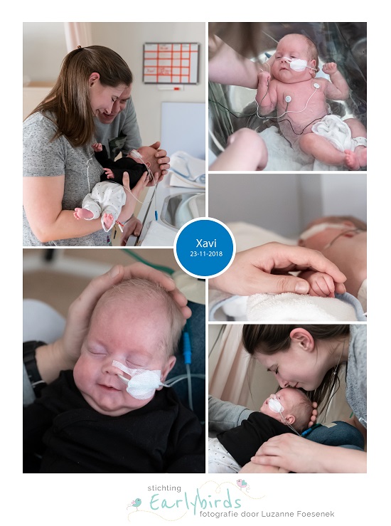 Xavi prematuur geboren met 25 weken en 2 dagen, sonde, Amphia Breda, ICSI, Sophia Kinderziekenhuis, weeenremmers, longrijping, EMC, stuitligging