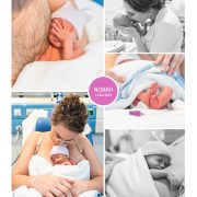 Norah prematuur geboren met 33 weken, Bronovo, couveuse, zwangerschapsvergiftiging, LUMC, sonde, buidelen