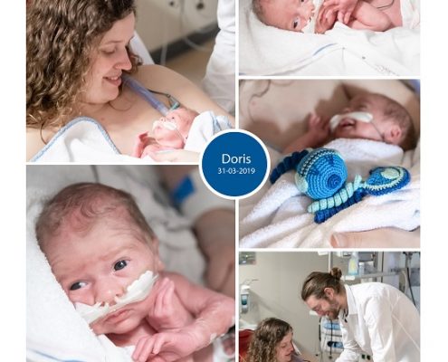 Doris prematuur geboren met 31 weken, AMphia Breda, neonatologie, zwangerschapsvergiftiging, Erasmus, couveuse, buidelen, sonde