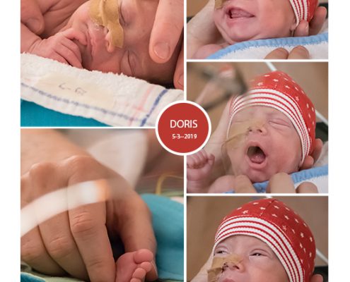 Doris prematuur geboren met 31 weken, /deventer zekenhuis, WKZ, groeiachterstand, spoedkeizersnede, Ronald McDonaldhuis, buidelen, couveuse, sonde