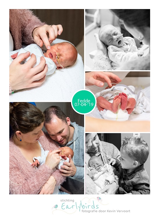 Fedde prematuur geboren met 35 weken, Bravis Bergen op Zoom, borstvoeding, sonde