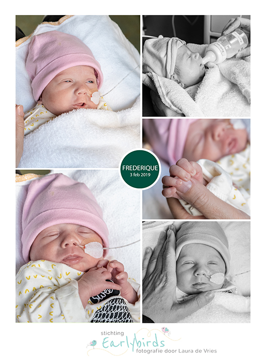 Frederique prematuur geboren met 29 weken, sonde, Rijnstate, vroeggeboorte