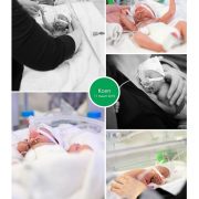 Koen prematuur geboren met 26 weken, buidelen, UMCG, CPAP, sonde, couveuse