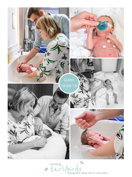 Quinn prematuur geboren met 32 weken, badderen, vroeggeboorte, kroelen, sonde