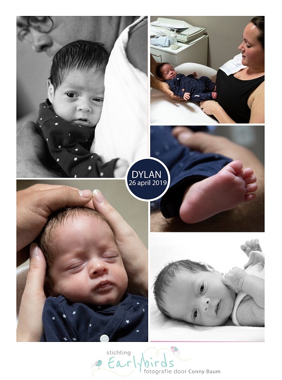 Dylan prematuur geboren met 32 weken, Bravis, longrijping, HELLP, zwnagerschapscholestase, MMC, keizersnede, NICU, couveuse