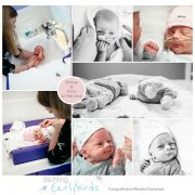 Emma & Anna prematuur geboren met 32 weken en 2 dagen, tweeling, TTTS, LUMC, UMCG, keizersnede, Martini ziekenhuis, sonde