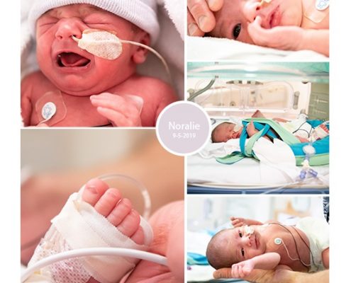 Noralie prematuur geboren emt 34+ weken, Rijnstate Arnhem, couveuse, antibiotica, sonde