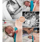 Pomme Hansje prematuur geboren met 29 weken, sonde, couveuse, vroeggeboorte