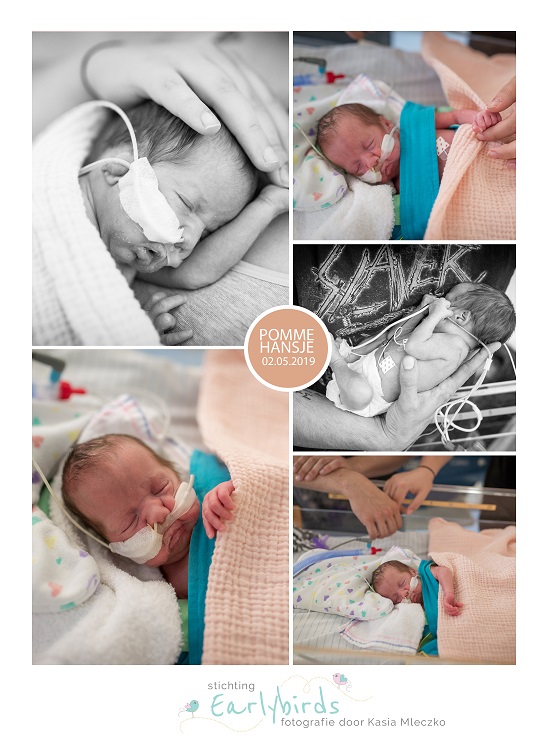 Pomme Hansje prematuur geboren met 29 weken, sonde, couveuse, vroeggeboorte