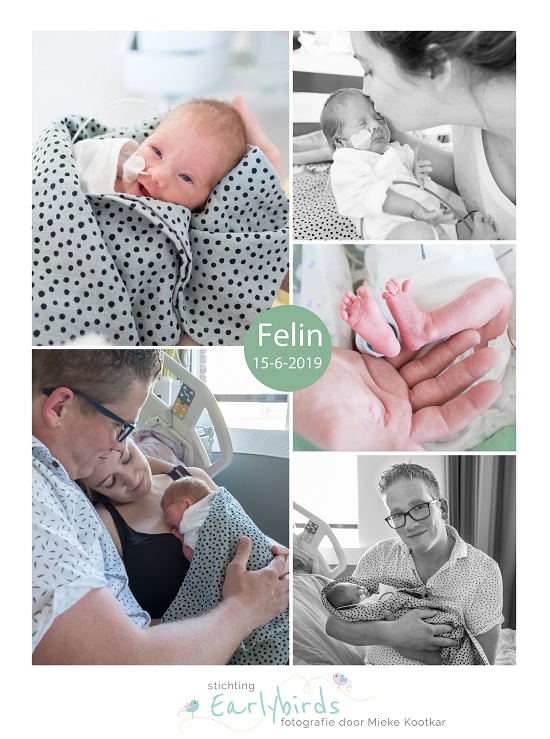 Felin prematuur geboren met 30 weken, MMC Veldhoven, spoedkeizersnede, sonde, Jeroen Bosch ziekenhuis