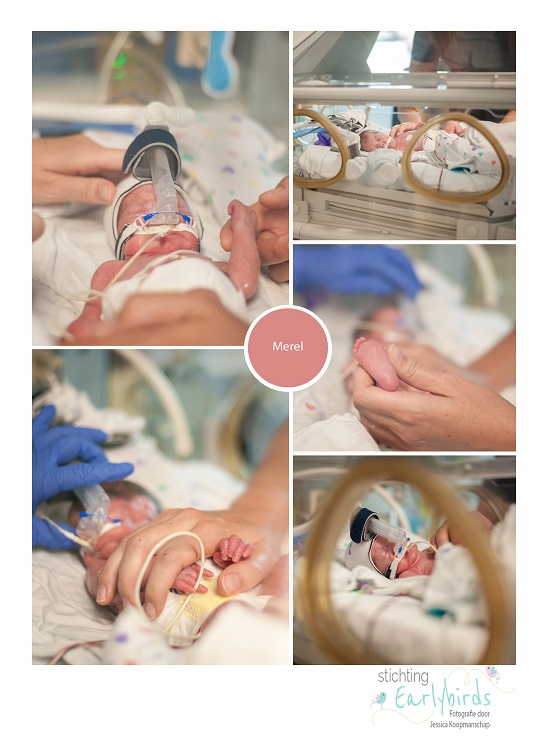 Merel prematuur geboren met 26 weken, weeenremmers, AMC, vroeggeboorte, CPAP, sonde, couveuse
