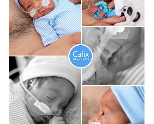 Calix prematuur geboren met 26 weken, sonde, vroeggeboorte, buidelen