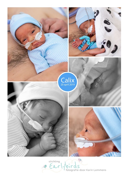 Calix prematuur geboren met 26 weken, sonde, vroeggeboorte, buidelen