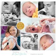 Jesse & Sara prematuur geboren met 35 weken, tweeling, Slingeland ziekenhuis, keizersnede, cholestase, groeiachterstand
