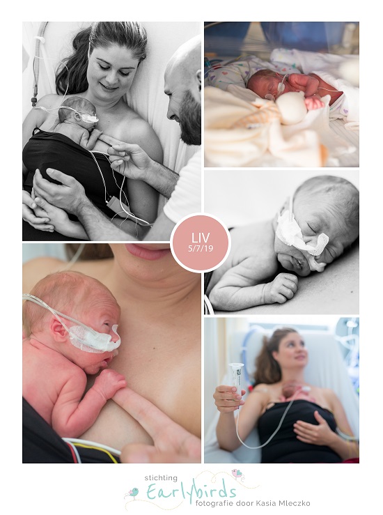 Liv prematuur geboren met 29 weken, sonde, buidelen, vroeggeboorte