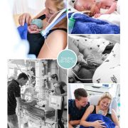 Sophie prematuur geboren met 26 weken, Sophia ziekenhuis, neonatologie, zwangerschapsvergiftiging, couveuse, buidelen, sonde