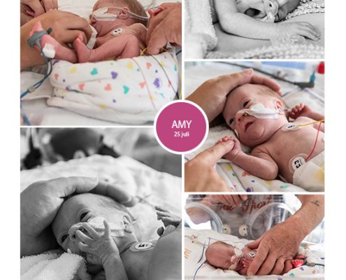Amy prematuur geboren met 28 weken en 4 dagen, keizersnede, St. Jansdal, zwangerschapsvergiftiging, MMC, Meander, sonde, couveuse