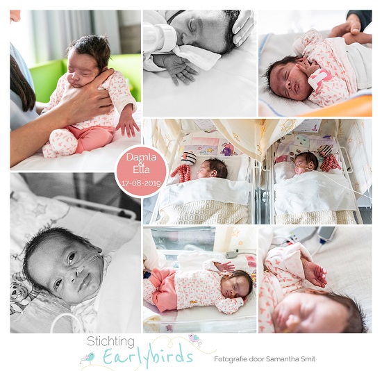 Ella & Damla prematuur geboren met 29 weken, tweeling, Spaarne Gasthuis, sonde