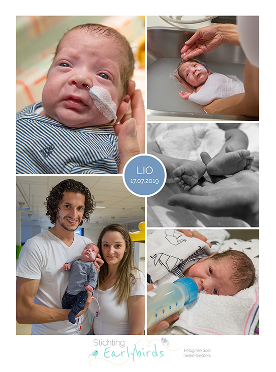 Lio prematuur geboren met 26 weken en 2 dagen, Sophia, sonde, vroeggeboorte, Antonius Nieuwegein, badderen
