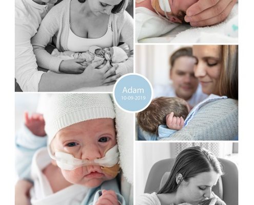 Adam prematuur geboren met 27 weken en 6 dagen, weeen remmers, keizersnede, stuitligging, borstvoeding, Maasstad ziekenhuis