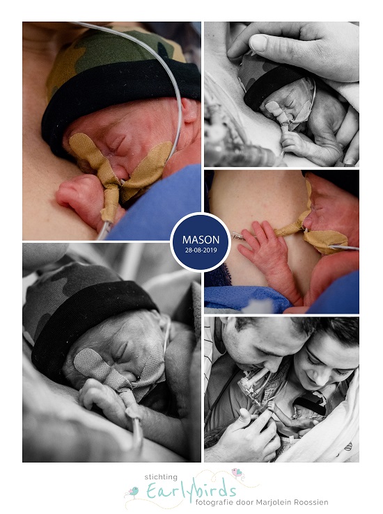 Mason prematuur geboren met 24 weken en 1 dag, longrijping, gebroken vliezen, Ronald McDonaldhuis, buidelen