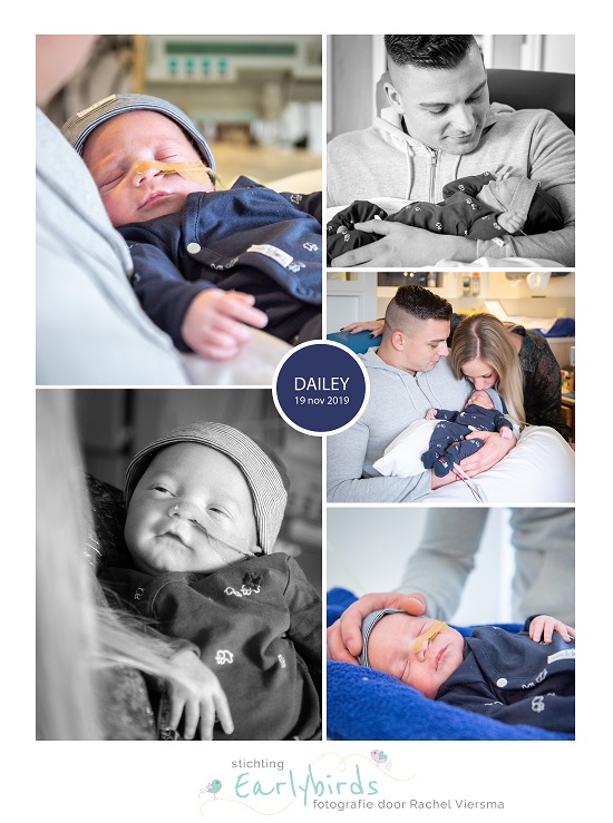 Dailey prematuur geboren met 33 weken en 5 dagen, Sophia Kinder Ziekenhuis, knuffelen, sonde, flesveding, vroeggeboorte