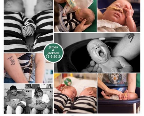 James & Jackson prematuur geboren met 26 weken, tweeling, deventer zkh, Radboud, weeen, couveuse