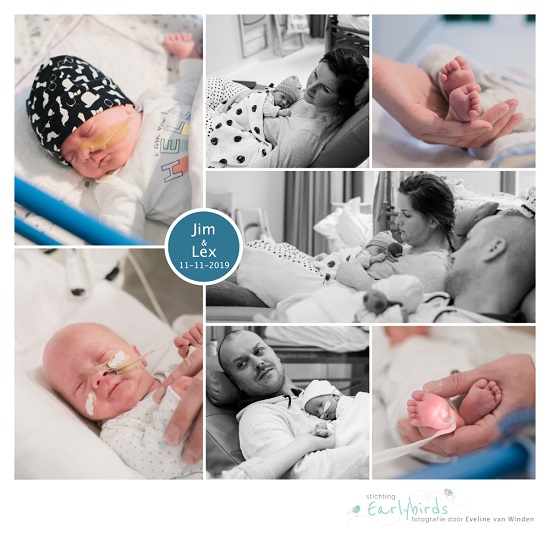 Jim & Lex prematuur geboren met 31 weken en 2 dagen, Reinier de Graaf, tweeling, keizersnede, buidelen, sonde