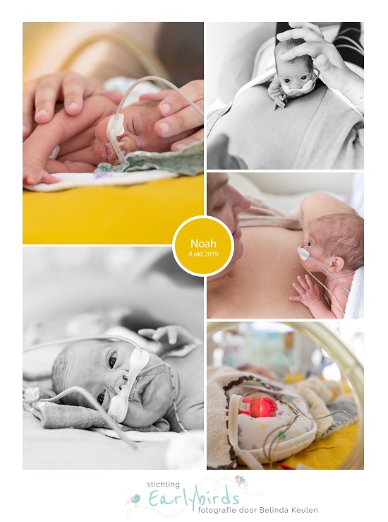 Noah prematuur geboren met 26 weken, MMC Veldhoven, couveuse, buidelen, weeenremmers, longrijping, sonde